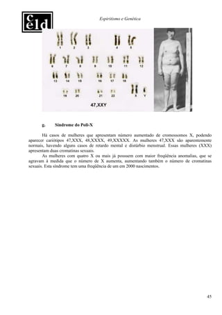 Espiritismo e Genética




      g.     Síndrome do Poli-X

       Há casos de mulheres que apresentam número aumentado de cromossomos X, podendo
aparecer cariótipos 47,XXX, 48,XXXX, 49,XXXXX. As mulheres 47,XXX são aparentemente
normais, havendo alguns casos de retardo mental e distúrbio menstrual. Essas mulheres (XXX)
apresentam duas cromatinas sexuais.
       As mulheres com quatro X ou mais já possuem com maior freqüência anomalias, que se
agravam à medida que o número de X aumenta, aumentando também o número de cromatinas
sexuais. Esta síndrome tem uma freqüência de um em 2000 nascimentos.




                                                                                        45
 