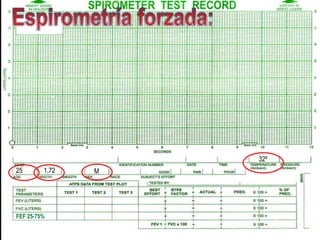 25 1,72 M
32º
FEF 25-75%
 