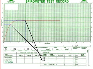 3,6
4,4
25 1,72 M
32º
FEF 25-75%
 