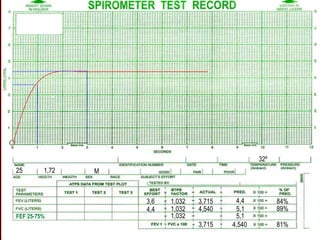 3,6
4,4
1,032
1,032
1,032
3,715
4,540
4,4
5,1
84%
89%
5,1
3,715 4,540 81%
25 1,72 M
32º
FEF 25-75%
 