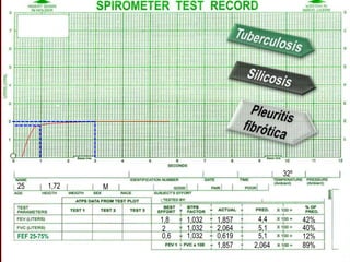 1,8
2
1,032
1,032
1,032
1,857
2,064
4,4
5,1
42%
40%
0,6190,6 5,1
1,857 2,064 89%
12%FEF 25-75%
25 1,72 M
32º
 