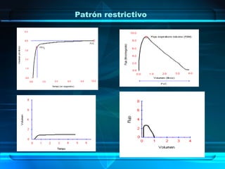 Patrón restrictivo
 