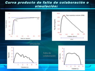 Curva producto de falta de colaboración o
simulación:
simulación
Falta de
colaboración
 