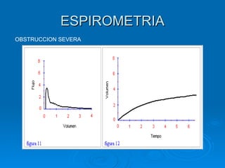 ESPIROMETRIA OBSTRUCCION SEVERA 