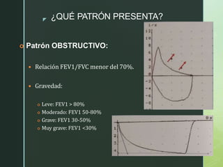 z ¿QUÉ PATRÓN PRESENTA?
 Patrón OBSTRUCTIVO:
 Relación FEV1/FVC menor del 70%.
 Gravedad:
 Leve: FEV1 > 80%
 Moderado: FEV1 50-80%
 Grave: FEV1 30-50%
 Muy grave: FEV1 <30%
 
