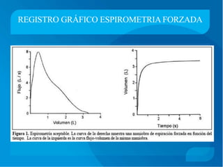 REGISTRO GRÁFICO ESPIROMETRIA FORZADA
 