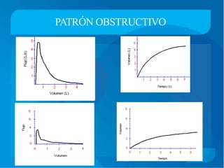 PATRÓN OBSTRUCTIVO
 