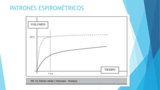 PATRONES ESPIROMÉTRICOS
 