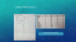 CASO PRÁCTICO 2
ESPROMETRÍA NORMAL
 