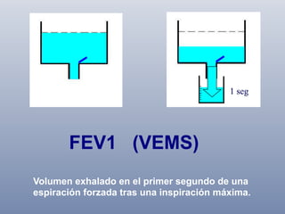FEV1 (VEMS)
Volumen exhalado en el primer segundo de una
espiración forzada tras una inspiración máxima.

 