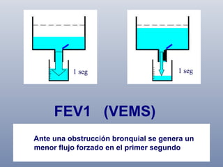 FEV1 (VEMS)
Ante una obstrucción bronquial se genera un
Volumen exhalado en el primer segundo de una
menor flujo forzado en el inspiración máxima.
espiración forzada tras una primer segundo

 