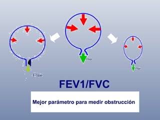 FEV1/FVC
% de la capacidad vital forzada que es
Mejor parámetro para primerobstrucción
expulsada durante el medir segundo

 