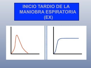 INICIO TARDIO DE LA
MANIOBRA ESPIRATORIA
(EX)

 