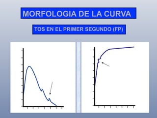 MORFOLOGIA DE LA CURVA
TOS EN EL PRIMER SEGUNDO (FP)

 