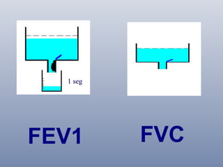 FEV1

FVC

 