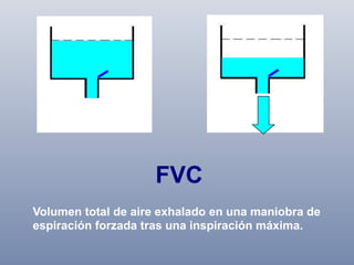 FVC
Volumen total de aire exhalado en una maniobra de
espiración forzada tras una inspiración máxima.

 