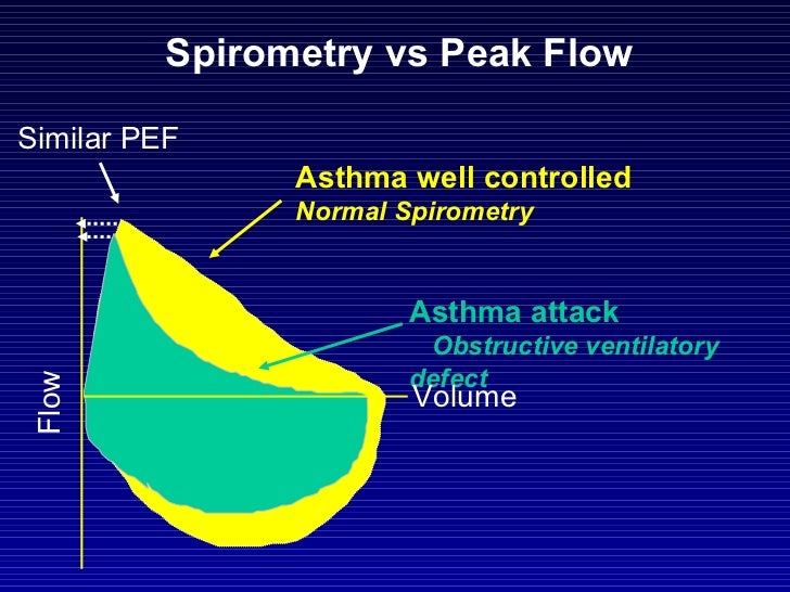 Espirometria gd