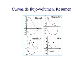 Curvas de flujo-volumen. Resumen.

 