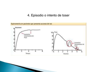 4. Episodio o intento de toser
 