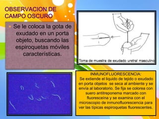 OBSERVACION DE
CAMPO OSCURO
  Se le coloca la gota de
   exudado en un porta
   objeto, buscando las
   espiroquetas móviles
     características.


                                     INMUNOFLUORESCENCIA:
                             Se extiende el liquido de tejido o exudado
                             en porta objetos se seca al ambiente y se
                             envía al laboratorio. Se fija se colorea con
                                 suero antitreponema marcado con
                                  fluoresceína y se examina con el
                             microscopio de inmunofluorescencia para
                             ver las típicas espiroquetas fluorescentes.
 