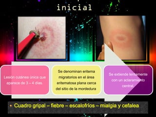 Se denominan eritema
                                                        Se extiende lentamente
Lesión cutánea única que    migratorios en el área
                                                         con un aclaramiento
 aparece de 3 – 4 días.    eritematosa plana cerca
                                                               central.
                           del sitio de la mordedura.



    Cuadro gripal – fiebre – escalofríos – mialgia y cefalea
 
