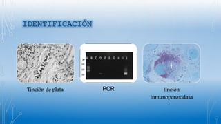 Tinción de plata PCR tinción
inmunoperoxidasa
 