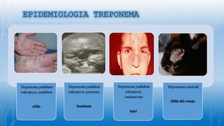 Treponema pallidum
subespecie pallidum
sífilis
Treponema pallidum
subespecie pertenue
frambesia
Treponema pallidum
subespecie
endemicum
bejel
Treponema cuniculi
Sífilis del conejo
 