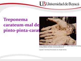 Treponema
carateum-mal del
pinto-pinta-carate
 