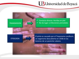 TRANSMISION
 Contacto directo: Heridas en piel
 No da lugar a infecciones prenatales
El pinto es causado por el Treponema carafeum,
un organismo descubierto en 1938 en las
lesiones de un paciente cubano.
ETIOLOGIA
 