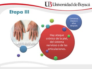 Etapa III
Hay ataque
crónico de la piel,
del sistema
nervioso o de las
articulaciones.
Comienza
meses o
años
después
 