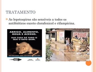 TRATAMENTO As lepstospiras são sensíveis a todos os antibióticos exceto clorafenicol e rifampicina. 
