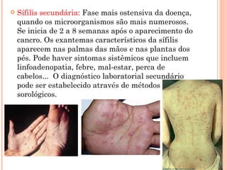 Sífilis secundária:  Fase mais ostensiva da doença, quando os microorganismos são mais numerosos. Se inicia de 2 a 8 semanas após o aparecimento do cancro. Os exantemas característicos da sífilis aparecem nas palmas das mãos e nas plantas dos pés. Pode haver sintomas sistêmicos que incluem linfoadenopatia, febre, mal-estar, perca de cabelos...  O diagnóstico laboratorial secundário pode ser estabelecido através de métodos sorológicos. 