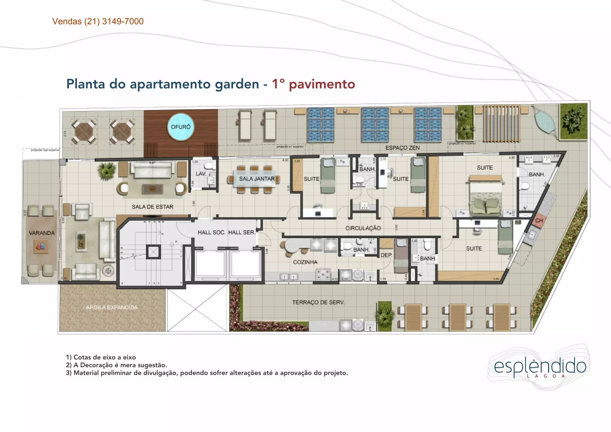 Vendas (21) 3149-7000