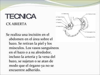 TECNICA CX ABIERTA Se realiza una incisión en el abdomen en el área sobre el bazo. Se retiran la piel y los músculos. Los vasos sanguíneos en el bazo o a su alrededor, incluso la arteria y la vena del bazo, se sujetan o se atan de modo que el órgano ya no se encuentre adherido.  