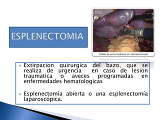 Esplenectomia PPT