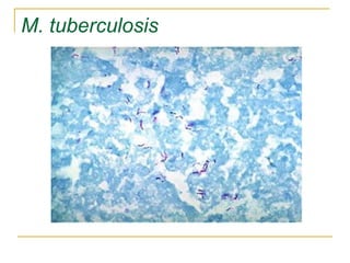 M. tuberculosis
 