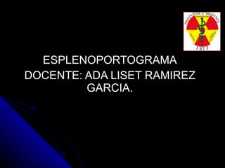 ESPLENOPORTOGRAMA DOCENTE: ADA LISET RAMIREZ GARCIA. 