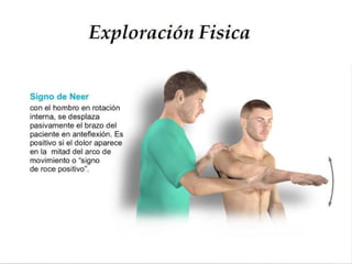  Exploracion Física del Hombro