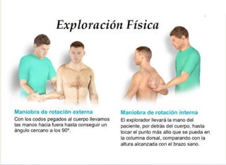  Exploracion Física del Hombro