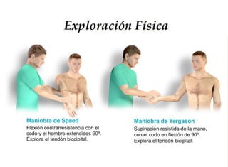  Exploracion Física del Hombro