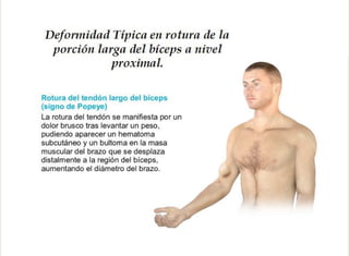  Exploracion Física del Hombro