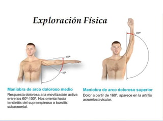  Exploracion Física del Hombro