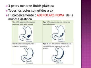3  pctes tuvieron linitis plástica
 Todos los pctes sometidos a cx
 Histológicamente : ADENOCARCINOMA de la
  mucosa gástrica
 