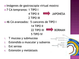  Imágenes de gastroscopia virtual mostro:
 7 CA tempranos: 1 TIPO I
                  4 TIPO II         JAPONESA
                  2 TIPO III
 46 CA avanzados: 5 canceres de TIPO I
                    14 TIPO II
                    22 TIPO III       BORMAN
                    5 TIPO IV
1. T mucosa y submucosa
2. Extendido a muscular y subserosa
3. Ext serosa
4. Extensión y metástasis
 