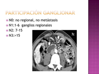  N0: no regional, no metástasis
 N1:1-6 ganglios regionales
 N2: 7-15
 N3:>15
 