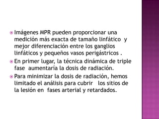  Imágenes   MPR pueden proporcionar una
  medición más exacta de tamaño linfático y
  mejor diferenciación entre los gang...