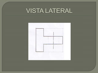 VISTA LATERAL