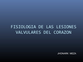 FISIOLOGIA DE LAS LESIONES
VALVULARES DEL CORAZON
JHONARK MEZA
 