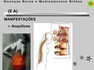 (E A)
MANIFESTAÇÕES
    Anquiliose
 