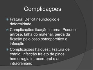 Complicações
 Fratura: Déficit neurológico e
deformidade
 Complicações fixação interna: Pseudo-
artrose, falha do material, perda da
fixação pelo osso osteoporótico e
infecção
 Complicações halovest: Fratura de
crânio, infecção trajeto de pinos,
hemorragia intracerebral e ar
intracraniano
 